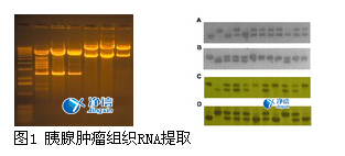 高通量组织研磨仪研磨胰腺肿瘤提取RNA的实验步骤